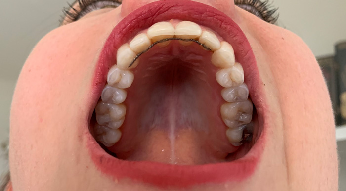 Top